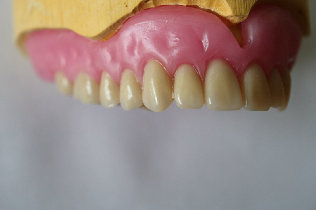 Cera (prueba de dientes): Prueba en cera para revisar estética, fonética y mordida.