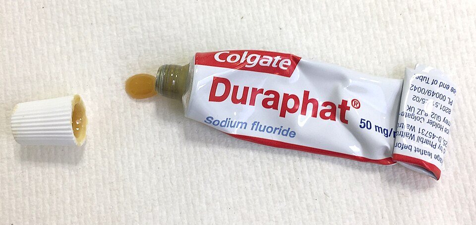 Barniz de flúor (fluoruro de sodio al 5 %): Barniz de flúor para aplicación profesional.